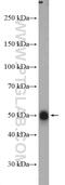 Ciliary Neurotrophic Factor Receptor antibody, 10796-1-AP, Proteintech Group, Western Blot image 