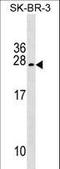 Trafficking Regulator Of GLUT4 (SLC2A4) 1 antibody, LS-C157300, Lifespan Biosciences, Western Blot image 