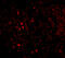 Interleukin 33 antibody, OAPB01354, Aviva Systems Biology, Immunofluorescence image 