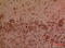 Glia Maturation Factor Beta antibody, STJ96878, St John