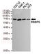 RB Binding Protein 5, Histone Lysine Methyltransferase Complex Subunit antibody, M04563, Boster Biological Technology, Western Blot image 