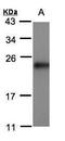 SRI antibody, GTX106105, GeneTex, Western Blot image 