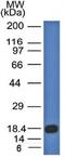 Melanoma Marker antibody, orb389015, Biorbyt, Western Blot image 