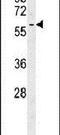 Dynein Cytoplasmic 1 Light Intermediate Chain 2 antibody, PA5-25392, Invitrogen Antibodies, Western Blot image 