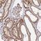 Peptide Deformylase, Mitochondrial antibody, NBP2-38993, Novus Biologicals, Immunohistochemistry paraffin image 