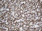 Kruppel Like Factor 11 antibody, M04277, Boster Biological Technology, Immunohistochemistry paraffin image 