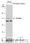 Protein Phosphatase 2 Regulatory Subunit B'Delta antibody, GTX106401, GeneTex, Western Blot image 