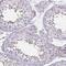 UL16 Binding Protein 3 antibody, NBP2-31866, Novus Biologicals, Immunohistochemistry paraffin image 