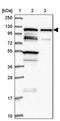 TBC1 Domain Family Member 2B antibody, PA5-61676, Invitrogen Antibodies, Western Blot image 