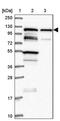 TBC1 Domain Family Member 2B antibody, PA5-61676, Invitrogen Antibodies, Western Blot image 