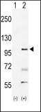 Ephrin type-A receptor 2 antibody, LS-C100255, Lifespan Biosciences, Western Blot image 