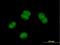 Nucleic Acid Binding Protein 2 antibody, H00079035-B01P, Novus Biologicals, Immunofluorescence image 