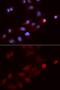 Small Nuclear Ribonucleoprotein Polypeptide E antibody, GTX33511, GeneTex, Immunofluorescence image 