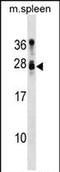 Tumor Suppressor Candidate 1 antibody, PA5-72128, Invitrogen Antibodies, Western Blot image 