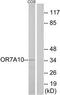 Olfactory Receptor Family 7 Subfamily A Member 10 antibody, TA316443, Origene, Western Blot image 
