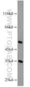 ATP Synthase Mitochondrial F1 Complex Assembly Factor 1 antibody, 15797-1-AP, Proteintech Group, Western Blot image 