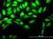 CDC28 Protein Kinase Regulatory Subunit 2 antibody, H00001164-M01, Novus Biologicals, Immunocytochemistry image 