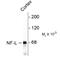 Neurofilament Light antibody, 50-256, ProSci, Western Blot image 