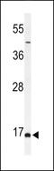 Biorientation Of Chromosomes In Cell Division 1 antibody, MBS9212369, MyBioSource, Western Blot image 