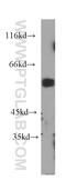 CD2 Molecule antibody, 60005-2-Ig, Proteintech Group, Western Blot image 