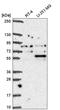 Coilin antibody, HPA068537, Atlas Antibodies, Western Blot image 