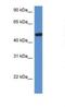 Hexosaminidase Subunit Alpha antibody, NBP1-74127, Novus Biologicals, Western Blot image 