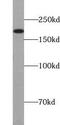 Endoglin antibody, FNab02761, FineTest, Western Blot image 