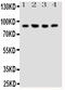 Neuregulin 2 antibody, GTX12019, GeneTex, Western Blot image 