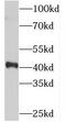 Synaptonemal Complex Central Element Protein 1 antibody, FNab08410, FineTest, Western Blot image 