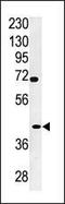 Tyrosylprotein Sulfotransferase 2 antibody, PA5-12138, Invitrogen Antibodies, Western Blot image 