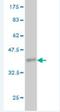 Angiopoietin Like 7 antibody, H00010218-M05-100ug, Novus Biologicals, Western Blot image 