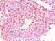 Chromogranin A antibody, NBP2-44772, Novus Biologicals, Immunohistochemistry frozen image 