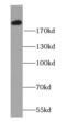 Myomesin 1 antibody, FNab05516, FineTest, Western Blot image 