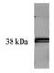 Transglutaminase 1 antibody, 90003, QED Bioscience, Western Blot image 