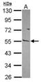 Matrix Metallopeptidase 13 antibody, NBP2-17310, Novus Biologicals, Western Blot image 