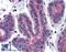 Ras Homolog Family Member A antibody, LS-B6004, Lifespan Biosciences, Immunohistochemistry paraffin image 