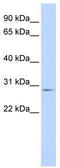 Myogenic Factor 6 antibody, TA329269, Origene, Western Blot image 