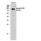 Lysine Acetyltransferase 2B antibody, LS-C387747, Lifespan Biosciences, Western Blot image 