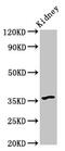 G Protein-Coupled Bile Acid Receptor 1 antibody, CSB-PA819471LA01HU, Cusabio, Western Blot image 