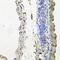 NADH:Ubiquinone Oxidoreductase Subunit A6 antibody, GTX65550, GeneTex, Immunohistochemistry paraffin image 