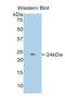 PZP Alpha-2-Macroglobulin Like antibody, LS-C298502, Lifespan Biosciences, Western Blot image 