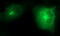 Secretory Carrier Membrane Protein 2 antibody, M08823, Boster Biological Technology, Immunofluorescence image 