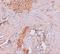 Epithelial Splicing Regulatory Protein 1 antibody, A06068, Boster Biological Technology, Immunohistochemistry paraffin image 