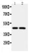 Caspase 2 antibody, PA1113, Boster Biological Technology, Western Blot image 