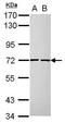 Cell Division Cycle 25A antibody, GTX102308, GeneTex, Western Blot image 