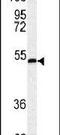 Serpin Family H Member 1 antibody, PA5-14254, Invitrogen Antibodies, Western Blot image 