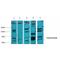 Nuclear Receptor Subfamily 3 Group C Member 1 antibody, LS-C387508, Lifespan Biosciences, Western Blot image 