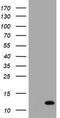 Protein S100-A6 antibody, LS-C175511, Lifespan Biosciences, Western Blot image 