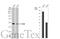 Paired Box 6 antibody, GTX113241, GeneTex, Western Blot image 