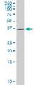 Glycogenin 1 antibody, H00002992-M08, Novus Biologicals, Western Blot image 